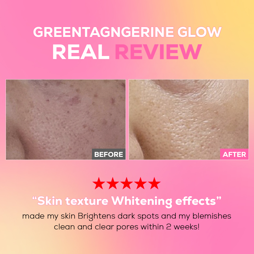 Green Tangerine Vita-C Dark Sport Clear Serum - Image 6