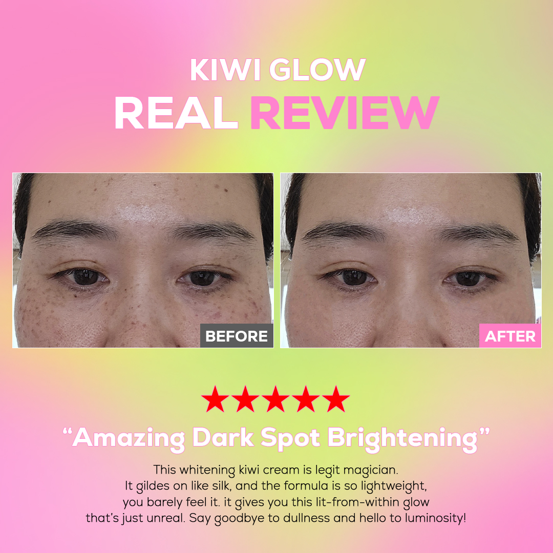 Kiwi Vita-C Dark Spot Clear Cream - Image 6